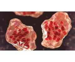 В Лос-Анджелесе подтвердили второй случай кори